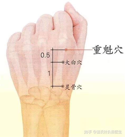 重魁穴|【史继霞】董氏针灸分享之【灵骨、大白、重魁三穴】